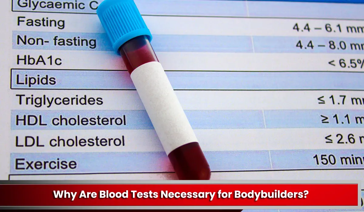 Why Are Blood Tests Necessary for Bodybuilders?